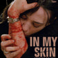 In My Skin Severin Films 4K UHD/Blu-Ray [PRE-ORDER]