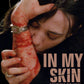 In My Skin Severin Films Blu-Ray [PRE-ORDER]